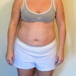 Front View Sami Cone Weight Loss