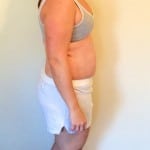 Side View Sami Cone Weight Loss